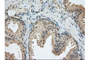 Immunohistochemical staining of paraffin-embedded Human liver tissue using anti-PDE4A mouse monoclonal antibody. (PDE4A 抗体)