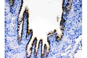 IHC analysis of AGRP using anti-AGRP antibody . (AGRP 抗体  (AA 82-131))