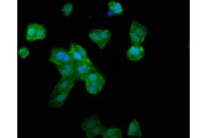 Immunofluorescence staining of HepG2 cells with ABIN7168260 at 1:133, counter-stained with DAPI. (RNF39 抗体  (AA 200-321))