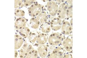 Immunohistochemistry of paraffin-embedded Human gastric using POU2F1 antibody at dilution of 1:100 (x400 lens). (POU2F1 抗体  (AA 15-290))