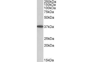 Western Blotting (WB) image for anti-Monoacylglycerol O-Acyltransferase 2 (MOGAT2) antibody (ABIN5903599) (MOGAT2 抗体)