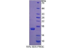 SDS-PAGE analysis of Rat CNR1 Protein. (CNR1 蛋白)