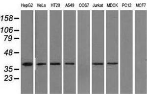 Western blot analysis of extracts (35 µg) from 9 different cell lines by using anti-IDH3A monoclonal antibody. (IDH3A 抗体)