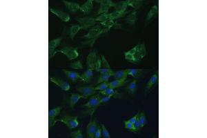 Immunofluorescence analysis of C6 cells using Adenosine Deaminase (Adenosine Deaminase (ADA)) antibody (ABIN3021281, ABIN3021282, ABIN3021283 and ABIN6214343) at dilution of 1:100. (ADA 抗体  (AA 1-363))