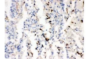 Anti- SFTP A1/2 Picoband antibody, IHC(P) IHC(P): Human Lung Cancer Tissue (SFTPA1/ 2 (AA 206-237), (C-Term) 抗体)