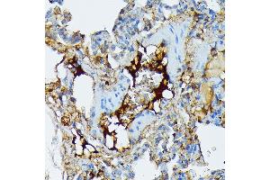 Immunohistochemistry of paraffin-embedded rat lung using Fibrinogen alpha chain (FGA) (FGA) Rabbit mAb (ABIN7267177) at dilution of 1:100 (40x lens). (FGA 抗体)