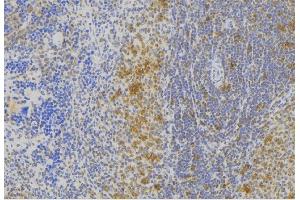 ABIN6273007 at 1/100 staining Human lymph node tissue by IHC-P. (Melanophilin 抗体  (C-Term))