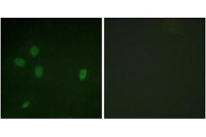 Immunofluorescent staining of NIH/3T3 cells reacted with TP53BP1 (phospho S25) polyclonal antibody  at 1:100-1:500 dilution. (TP53BP1 抗体  (pSer25))