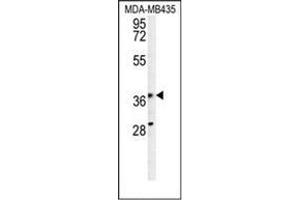 Western blot analysis of PRPSAP1 Antibody (N-term) in MDA-MB435 cell line lysates (35ug/lane). (PRPSAP1 抗体  (N-Term))