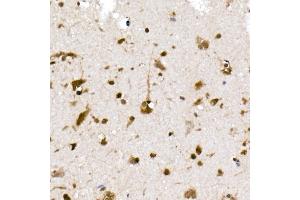 Immunohistochemistry of paraffin-embedded human brain using UB Rabbit mAb (ABIN7271128) at dilution of 1:50 (40x lens).