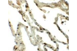 Immunohistochemical staining of human lung cells with TSN polyclonal antibody  at 5 ug/mL. (Translin 抗体  (C-Term))