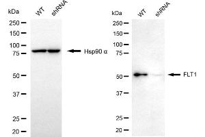 Western blotting analysis using FLT1 antibody (ABIN7798636). (FLT1 抗体)