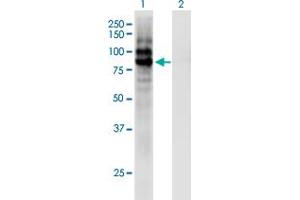 Western Blot analysis of CPXM1 expression in transfected 293T cell line by CPXM1 monoclonal antibody (M02), clone 2G5. (CPXM1 抗体  (AA 610-718))