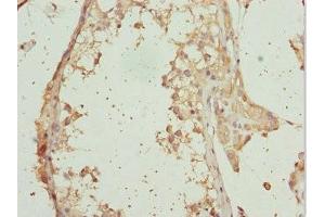 Immunohistochemistry of paraffin-embedded human testis tissue using ABIN7167292 at dilution of 1:100 (RAB31 抗体  (AA 1-194))