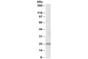 Western blot testing of human prostate lysate with IL-25 antibody at 0. (IL-25 抗体)