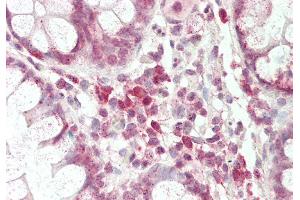 Rabbit Anti-Pou3f1 antibody Catalog Number: ARP33060 Formalin Fixed Paraffin Embedded Tissue: Human Small Intestine Primary antibody Concentration: 1:100 Secondary Antibody: Donkey anti-Rabbit-Cy3 Secondary Antibody Concentration: 1:200 Magnification: 20x Exposure Time: 0. (POU3F1 抗体  (C-Term))
