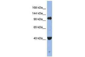 EIF2C4 antibody used at 1 ug/ml to detect target protein. (AGO4 抗体  (Middle Region))
