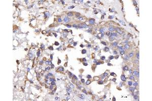 IHC analysis of DLST using anti-DLST antibody (ABIN7599412). (DLST 抗体  (AA 1-453))