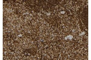 ABIN6265922 and ABIN6279898 at 1/100 staining Mouse spleen tissue by IHC-P.