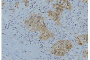 ABIN6266627 at 1/100 staining Human uterus tissue by IHC-P. (Prostate Specific Antigen 抗体  (Internal Region))