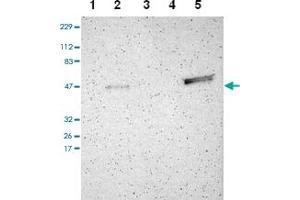Western blot analysis of Lane 1: RT-4, Lane 2: U-251 MG, Lane 3: Human Plasma, Lane 4: Liver, Lane 5: Tonsil with TRAF1 polyclonal antibody .
