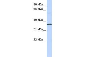 WB Suggested Anti-C16orf46 Antibody Titration: 0. (C16ORF46 抗体  (N-Term))