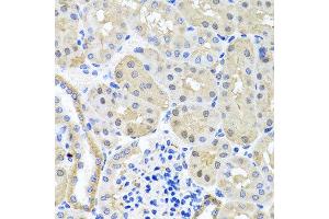 Immunohistochemistry of paraffin-embedded mouse kidney using BSND antibody at dilution of 1:100 (x40 lens). (BSND 抗体)