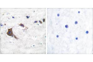 Peptide - +Immunohistochemical analysis of paraffin-embedded human brain tissue using ERAB antibody.