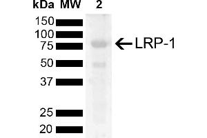 Western blot analysis of Rat Kidney showing detection of 504. (LRP1 抗体  (AA 2880-2980) (Biotin))