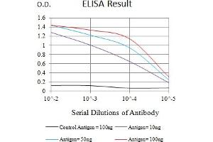 Black line: Control Antigen (100 ng),Purple line: Antigen (10 ng), Blue line: Antigen (50 ng), Red line:Antigen (100 ng) (ITGAD 抗体  (AA 18-172))