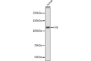 Western blot analysis of extracts of Jurkat cells, using FYB antibody (ABIN7267283) at 1:1000 dilution. (FYB 抗体  (AA 678-829))