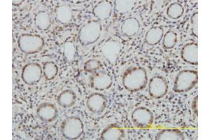 Immunoperoxidase of monoclonal antibody to TOP1 on formalin-fixed paraffin-embedded human stomach. (Topoisomerase I 抗体  (AA 692-765))