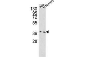 Western blot analysis of OGG1 Antibody (C-term) in Hela, NIH-3T3 cell line lysates (35ug/lane). (OGG1 抗体  (C-Term))