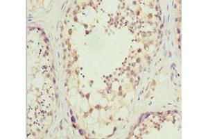 Immunohistochemistry of paraffin-embedded human testis tissue using ABIN7170027 at dilution of 1:100 (SLC9A6 抗体  (AA 510-669))