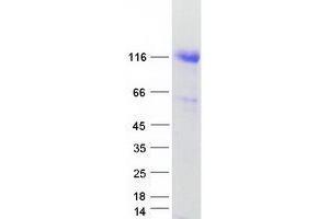 UBA1 Protein (Transcript Variant 1) (Myc-DYKDDDDK Tag)