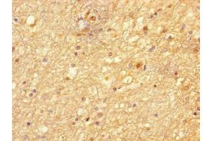 Immunohistochemistry of paraffin-embedded human brain tissue using ABIN7169120 at dilution of 1:100 (NIM1 抗体  (AA 1-436))