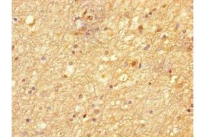 Immunohistochemistry of paraffin-embedded human brain tissue using ABIN7169120 at dilution of 1:100