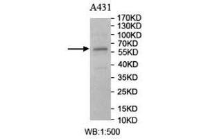 Western Blotting (WB) image for anti-Carnosine Dipeptidase 1 (Metallopeptidase M20 Family) (CNDP1) antibody (ABIN5907141) (CNDP1 抗体)