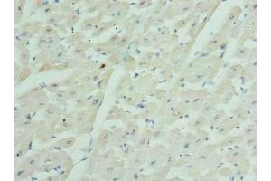 Immunohistochemistry of paraffin-embedded human heart tissue using ABIN7153593 at dilution of 1:100 (GJA4 抗体  (AA 231-333))