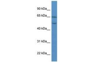 Image no. 1 for anti-Collagen, Type VIII, alpha 2 (COL8A2) (AA 469-518) antibody (ABIN6746741)