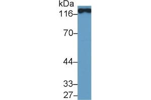 Detection of ACE2 in Porcine Kidney lysate using Polyclonal Antibody to Angiotensin I Converting Enzyme 2 (ACE2) (ACE2 抗体  (AA 392-739))