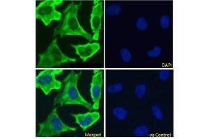 Immunofluoresence staining of fixed HeLa cells with anti-EGFR antibody 528. (Recombinant EGFR 抗体)