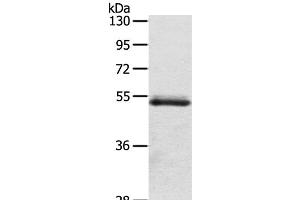 Western Blot analysis of Human normal colon sigmoideum tissue using OLFM4 Polyclonal Antibody at dilution of 1:200 (Olfactomedin 4 抗体)