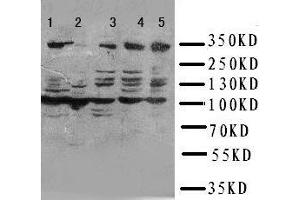 Anti-ATM antibody, Western blotting Lane 1: HELA Cell Lysate Lane 2: SMMC Cell Lysate Lane 3: U87 Cell Lysate Lane 4: A549 Cell Lysate Lane 5: MCF-7 Cell Lysate (ATM 抗体  (N-Term))