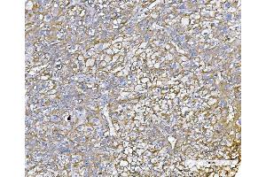 IHC analysis of Poliovirus Receptor/PVR using anti-Poliovirus Receptor/PVR antibody (ABIN7601077).