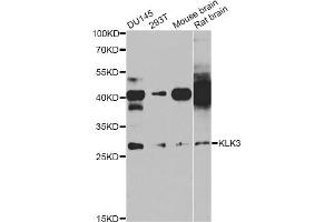 Western blot analysis of extracts of various cell lines, using KLK3 antibody (ABIN5971083) at 1/1000 dilution. (Prostate Specific Antigen 抗体)