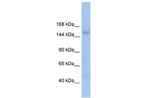 MOV10L1 antibody used at 1 ug/ml to detect target protein. (MOV10L1 抗体)
