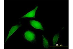 Immunofluorescence of purified MaxPab antibody to PSMD14 on HeLa cell. (PSMD14 抗体  (AA 1-310))