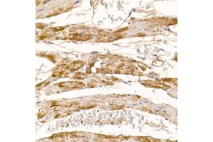 Immunohistochemistry of paraffin-embedded mouse heart using COX7 Rabbit pAb (4721) at dilution of 1:100 (40x lens). (COX7A1 抗体  (AA 1-79))