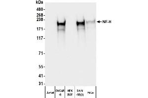 Western Blotting (WB) image for Mouse anti-Chicken IgY Light Chain (Light Chain) antibody (ABIN7795617)